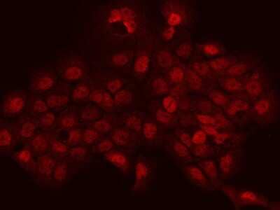 Immunocytochemistry/ Immunofluorescence: PHTF2 Antibody [NBP2-97689]