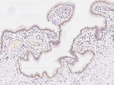 Immunohistochemistry-Paraffin: PHTF2 Antibody [NBP2-97689]