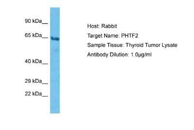 Western Blot: PHTF2 Antibody [NBP2-83393]