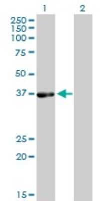 Western Blot: PHYH Antibody (1F2-5B9) [H00005264-M01]