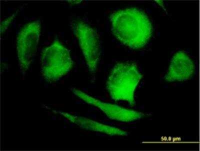 Immunocytochemistry/ Immunofluorescence: PHYH Antibody [H00005264-B01P]