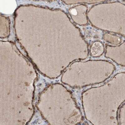 Immunohistochemistry-Paraffin: PHYH Antibody [NBP1-87348]