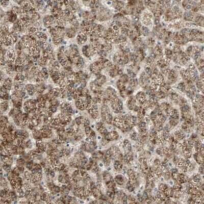 Immunohistochemistry-Paraffin: PHYH Antibody [NBP1-87349]