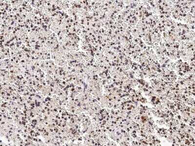 Immunohistochemistry-Paraffin: PHYH Antibody [NBP3-00120]