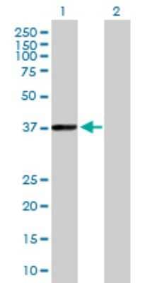 Western Blot: PHYH Antibody [H00005264-B01P]