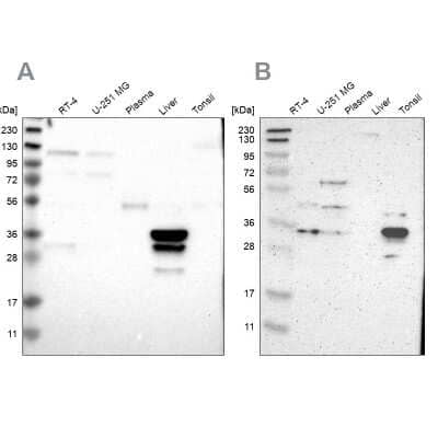 Western Blot: PHYH Antibody [NBP1-87348]