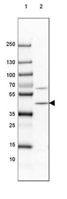 Western Blot: PHYH Antibody [NBP1-87349]