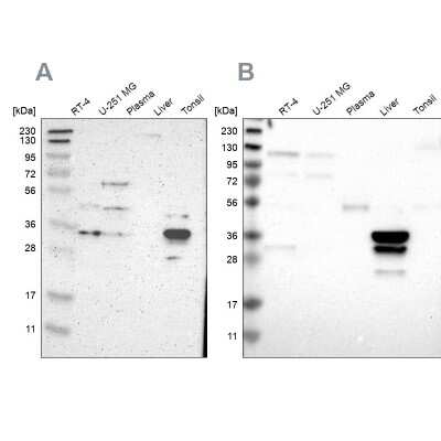 Western Blot: PHYH Antibody [NBP1-87349]
