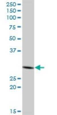 Western Blot: PHYHD1 Antibody [H00254295-B01P]