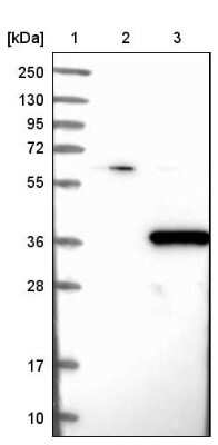 Western Blot: PHYHD1 Antibody [NBP1-81187]