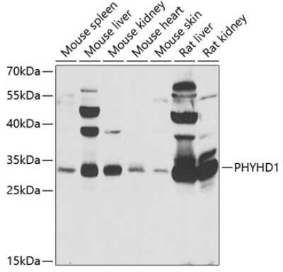 Western Blot: PHYHD1 AntibodyBSA Free [NBP2-93015]