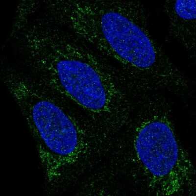 Immunocytochemistry/ Immunofluorescence: PHYHIP Antibody [NBP2-49594]