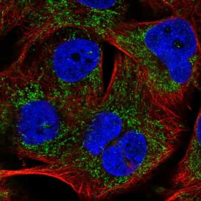 Immunocytochemistry/ Immunofluorescence: PHYHIP Antibody [NBP2-57296]