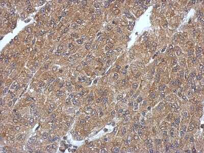 Immunohistochemistry-Paraffin: PHYHIP Antibody [NBP2-19813]