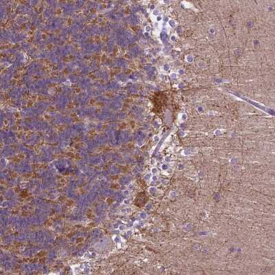 Immunohistochemistry-Paraffin: PHYHIP Antibody [NBP2-49594]