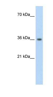 Western Blot: PHYHIP Antibody [NBP1-56325]