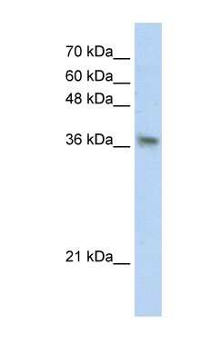 Western Blot: PHYHIP Antibody [NBP1-56336]