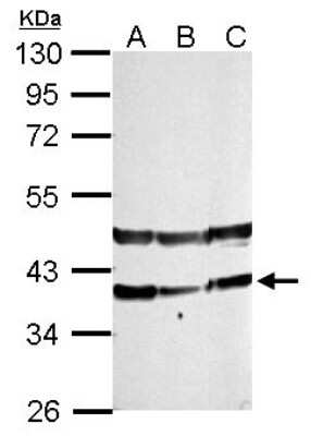 Western Blot: PHYHIP Antibody [NBP2-19813]