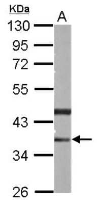 Western Blot: PHYHIP Antibody [NBP2-19813]