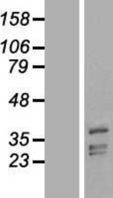 Western Blot: PHYHIP Overexpression Lysate [NBL1-14376]