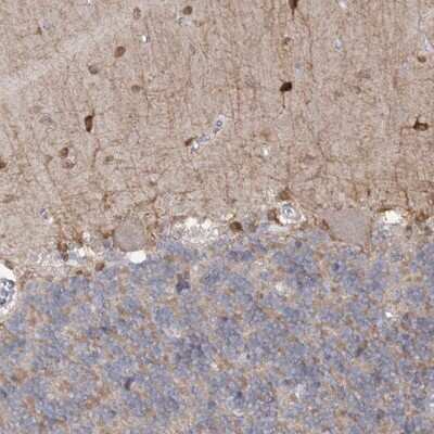 Immunohistochemistry-Paraffin: PHYHIPL Antibody [NBP1-84858]