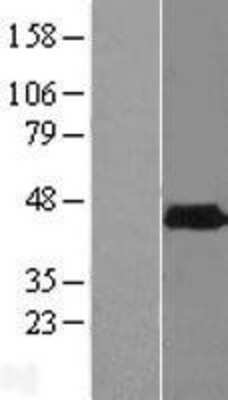 Western Blot: PHYHIPL Overexpression Lysate [NBL1-14377]