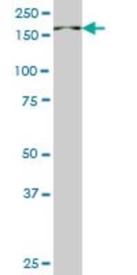 Western Blot: PI 3-Kinase C2 beta Antibody (1H4) [H00005287-M06]