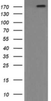 Western Blot: PI 3-Kinase C2 beta Antibody (OTI3B1) [NBP2-46402]