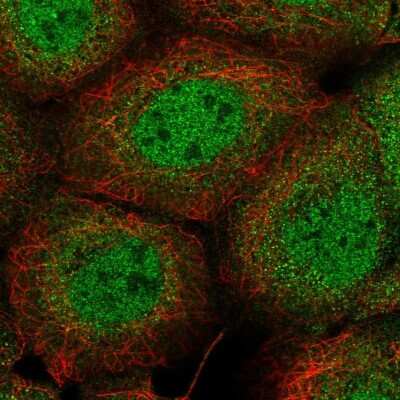 Immunocytochemistry/ Immunofluorescence: PI 3-Kinase C2 beta Antibody [NBP2-58352]