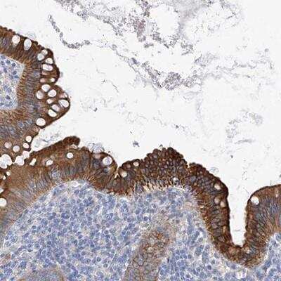 Immunohistochemistry: PI 3-Kinase C2 beta Antibody [NBP1-86795]