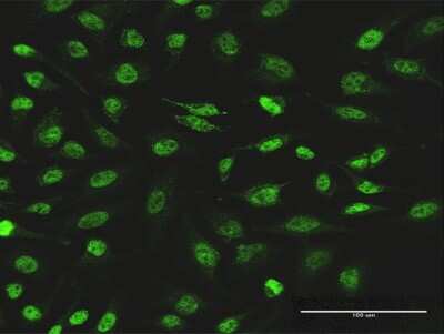 Immunocytochemistry/ Immunofluorescence: PI 3-Kinase p110 beta/PIK3CB Antibody (10D5) [H00005291-M03]