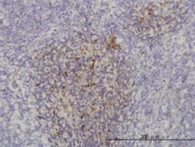 Immunohistochemistry-Paraffin: PI 3-Kinase p110 beta/PIK3CB Antibody (4H2) [H00005291-M01]