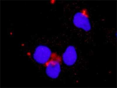 Proximity Ligation Assay: PI 3-Kinase p110 beta/PIK3CB Antibody (4H2) [H00005291-M01]