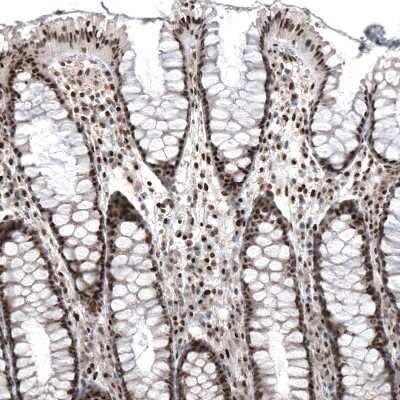 Immunohistochemistry-Paraffin: PI 3-Kinase p110 beta/PIK3CB Antibody (CL9518) [NBP2-88937]
