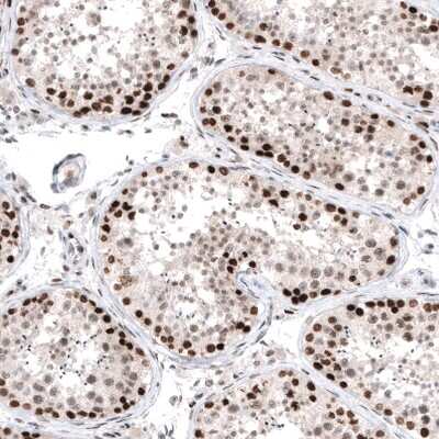 Immunohistochemistry-Paraffin: PI 3-Kinase p110 beta/PIK3CB Antibody (CL9518) [NBP2-88937]