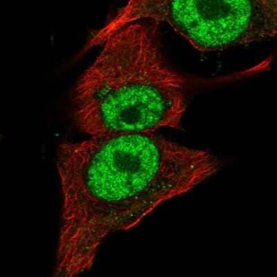 Immunocytochemistry/ Immunofluorescence: PI 3-Kinase p110 beta/PIK3CB Antibody [NBP2-56397]