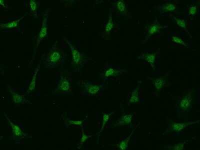 Immunocytochemistry/ Immunofluorescence: PI 3-Kinase p110 beta/PIK3CB Antibody [NBP2-99597]