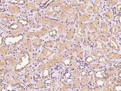 Immunohistochemistry-Paraffin: PI 3-Kinase p110 beta/PIK3CB Antibody [NBP2-99597]