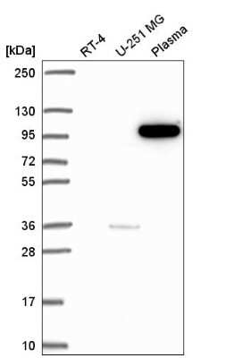 Western Blot: PI 3-Kinase p110 beta/PIK3CB Antibody [NBP2-56397]