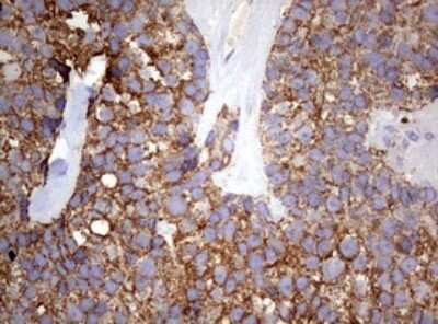 Immunohistochemistry: PI 3-Kinase p110 delta Antibody (OTI1D11) [NBP2-46404]