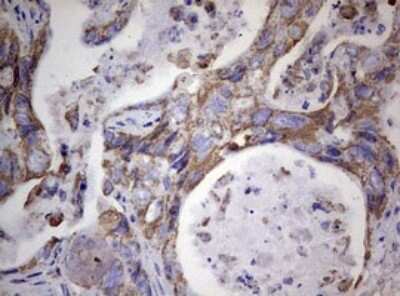 Immunohistochemistry: PI 3-Kinase p110 delta Antibody (OTI1D11) [NBP2-46404]