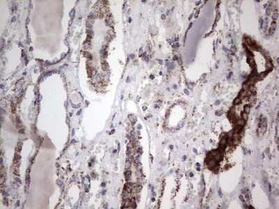 Immunohistochemistry: PI 3-Kinase p110 delta Antibody (OTI1D11) [NBP2-46404]