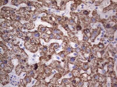 Immunohistochemistry: PI 3-Kinase p110 delta Antibody (OTI1D11) [NBP2-46404]