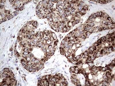 Immunohistochemistry: PI 3-Kinase p110 delta Antibody (OTI1D11) [NBP2-46404]