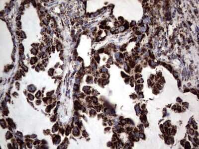 Immunohistochemistry: PI 3-Kinase p110 delta Antibody (OTI1D11) [NBP2-46404]