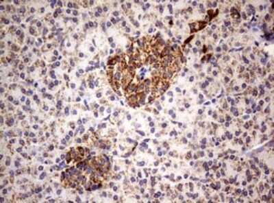 Immunohistochemistry: PI 3-Kinase p110 delta Antibody (OTI1D11) [NBP2-46404]