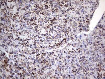 Immunohistochemistry: PI 3-Kinase p110 delta Antibody (OTI1D11) [NBP2-46404]