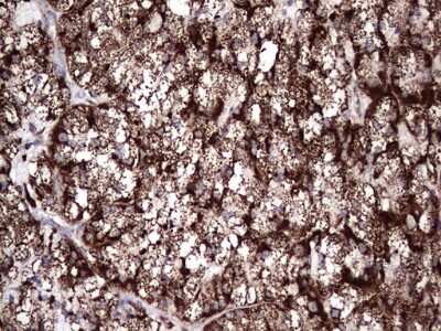 Immunohistochemistry: PI 3-Kinase p110 delta Antibody (OTI1D11) [NBP2-46404]