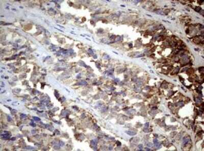 Immunohistochemistry: PI 3-Kinase p110 delta Antibody (OTI1D11) [NBP2-46404]