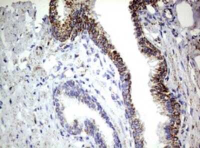 Immunohistochemistry: PI 3-Kinase p110 delta Antibody (OTI1D11) [NBP2-46404]